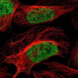 ZNF532 Antibody, Novus Biologicals 25 &mu;L; Unlabeled:Antibodies, Polyclonal